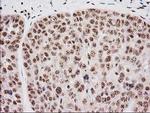 MGLL Antibody in Immunohistochemistry (Paraffin) (IHC (P))