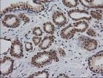 MGLL Antibody in Immunohistochemistry (Paraffin) (IHC (P))