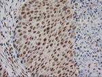 MGLL Antibody in Immunohistochemistry (Paraffin) (IHC (P))