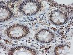 MGLL Antibody in Immunohistochemistry (Paraffin) (IHC (P))