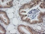 MGLL Antibody in Immunohistochemistry (Paraffin) (IHC (P))