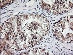 MGLL Antibody in Immunohistochemistry (Paraffin) (IHC (P))