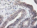 MGLL Antibody in Immunohistochemistry (Paraffin) (IHC (P))