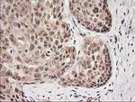 MGLL Antibody in Immunohistochemistry (Paraffin) (IHC (P))