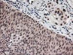 MGLL Antibody in Immunohistochemistry (Paraffin) (IHC (P))