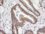 MGLL Antibody in Immunohistochemistry (Paraffin) (IHC (P))