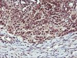 MGLL Antibody in Immunohistochemistry (Paraffin) (IHC (P))