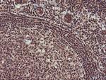 MGLL Antibody in Immunohistochemistry (Paraffin) (IHC (P))