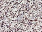 MGLL Antibody in Immunohistochemistry (Paraffin) (IHC (P))