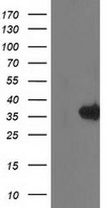 MGLL Antibody in Western Blot (WB)