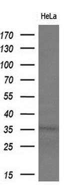 MGLL Antibody in Western Blot (WB)