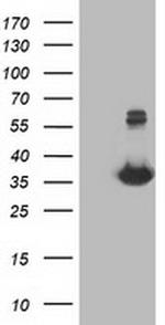 MGLL Antibody in Western Blot (WB)