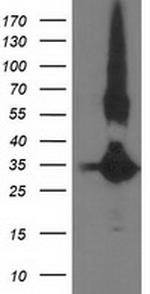 MGLL Antibody in Western Blot (WB)