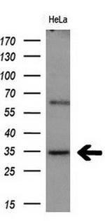 MGLL Antibody in Western Blot (WB)