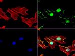 MGMT Antibody in Immunocytochemistry (ICC/IF)