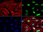 MGMT Antibody in Immunocytochemistry (ICC/IF)