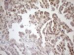 MGMT Antibody in Immunohistochemistry (Paraffin) (IHC (P))