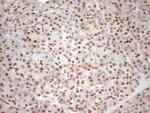 MGMT Antibody in Immunohistochemistry (Paraffin) (IHC (P))