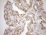 MGMT Antibody in Immunohistochemistry (Paraffin) (IHC (P))