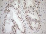 MGMT Antibody in Immunohistochemistry (Paraffin) (IHC (P))