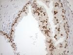 MGMT Antibody in Immunohistochemistry (Paraffin) (IHC (P))