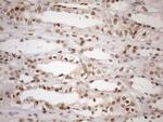 MGMT Antibody in Immunohistochemistry (Paraffin) (IHC (P))