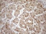 MGMT Antibody in Immunohistochemistry (Paraffin) (IHC (P))