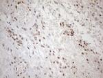 MGMT Antibody in Immunohistochemistry (Paraffin) (IHC (P))