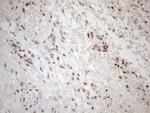 MGMT Antibody in Immunohistochemistry (Paraffin) (IHC (P))