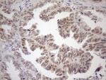 MGMT Antibody in Immunohistochemistry (Paraffin) (IHC (P))