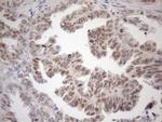 MGMT Antibody in Immunohistochemistry (Paraffin) (IHC (P))