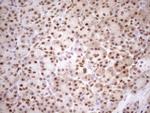 MGMT Antibody in Immunohistochemistry (Paraffin) (IHC (P))