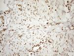 MGMT Antibody in Immunohistochemistry (Paraffin) (IHC (P))