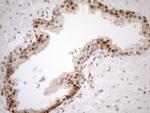 MGMT Antibody in Immunohistochemistry (Paraffin) (IHC (P))