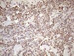 MGMT Antibody in Immunohistochemistry (Paraffin) (IHC (P))