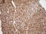 MGMT Antibody in Immunohistochemistry (Paraffin) (IHC (P))