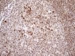 MGMT Antibody in Immunohistochemistry (Paraffin) (IHC (P))