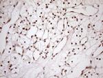 MGMT Antibody in Immunohistochemistry (Paraffin) (IHC (P))