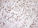 MGMT Antibody in Immunohistochemistry (Paraffin) (IHC (P))