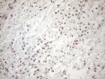 MGMT Antibody in Immunohistochemistry (Paraffin) (IHC (P))