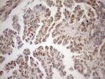 MGMT Antibody in Immunohistochemistry (Paraffin) (IHC (P))