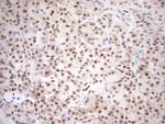 MGMT Antibody in Immunohistochemistry (Paraffin) (IHC (P))