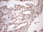 MGMT Antibody in Immunohistochemistry (Paraffin) (IHC (P))