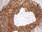 MGMT Antibody in Immunohistochemistry (Paraffin) (IHC (P))