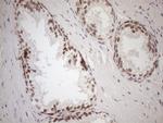 MGMT Antibody in Immunohistochemistry (Paraffin) (IHC (P))