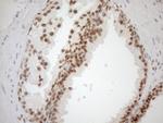 MGMT Antibody in Immunohistochemistry (Paraffin) (IHC (P))