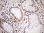 MGMT Antibody in Immunohistochemistry (Paraffin) (IHC (P))