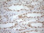 MGMT Antibody in Immunohistochemistry (Paraffin) (IHC (P))