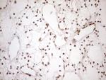 MGMT Antibody in Immunohistochemistry (Paraffin) (IHC (P))