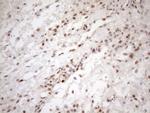 MGMT Antibody in Immunohistochemistry (Paraffin) (IHC (P))